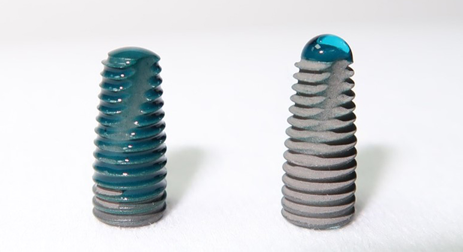 低溫等離子體處理提高牙本質黏接強度